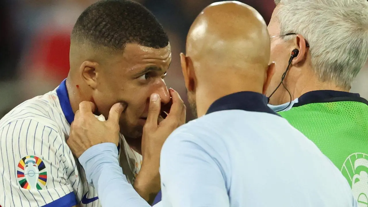 El delantero francés Kylian Mbappe es atendido por los médicos durante el partido que han jugado Austria y Francia en Dusseldorf, Alemania. EFE/EPA/FRIEDEMANN VOGEL